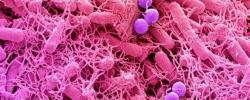 细菌是如何成为肿瘤帮凶的？