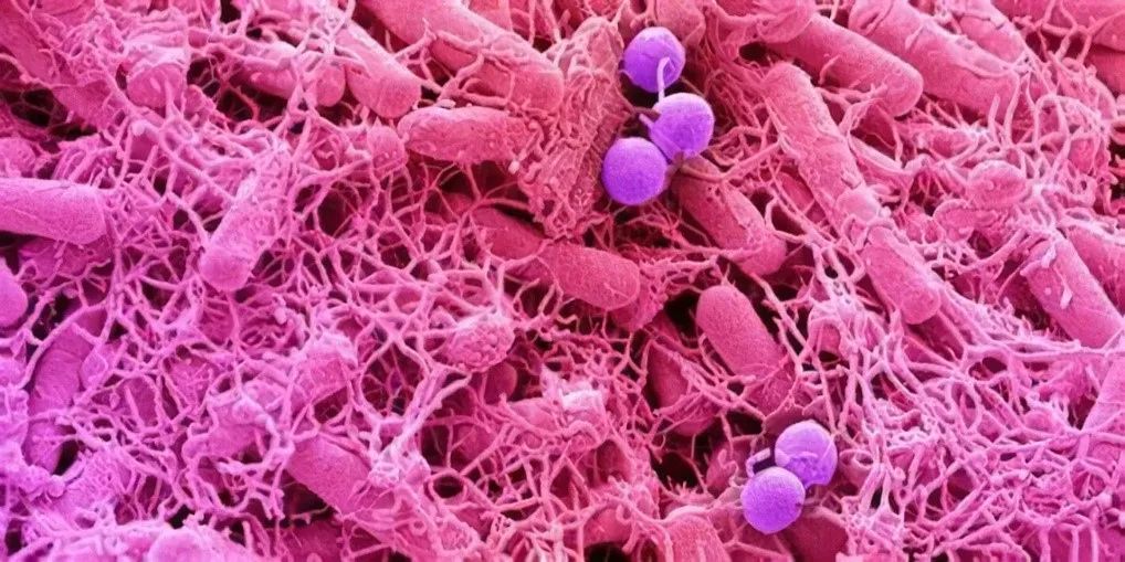 细菌是如何成为肿瘤帮凶的？,图片,细菌,双歧杆菌,幽门螺杆菌,益生菌,肿瘤,胃癌,第1张