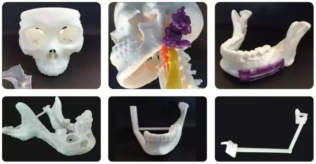 生物3D打印助力健康中国 — Print me an organ究竟还有多远？,图片,活性,手术,稳定性,分子,化学,3D打印,人体器官芯片,第3张