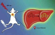 Anal Chem：小鼠早期肝纤维化的快速荧光诊断方法