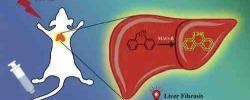 Anal Chem：小鼠早期肝纤维化的快速荧光诊断方法