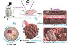 长春应化所金永东研究员《Adv.Mater.》：超声影像引导下的电化学产氢/声动力联合多米诺肿瘤治疗