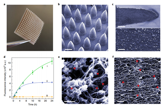浙大顾臻团队Nat. Nano：生物正交催化反应贴片，实现快速精准可去除的反应给药！,图片,反应给药,生物正交催化,金属催化,剂量,金属纳米颗粒,第3张
