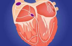 西安交大唐敬达、哈佛大学锁志刚院士《Sci. Adv.》: 心脏瓣膜组织的抗疲劳机理